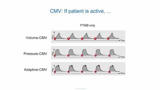 eLearning Ventilation modes ABC [upl. by Alina]