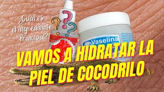 PIEL SECA 💥 DOSIS EXTRA PARA HIDRATAR LA PIEL DE COCODRILO 🐊 [upl. by Haliled]