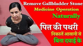 Gallbladder Stones  Remove Naturally l Gallstones l Gallbladder Pain l Healthcity [upl. by Batty716]