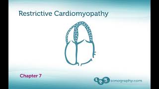 Echocardiography Restrictive Cardiomyopathy with Examples and Echo Demonstration [upl. by Trauts]