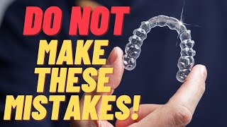 The Ultimate Invisalign Guide  Top Things To Know Before You Start [upl. by Oech]