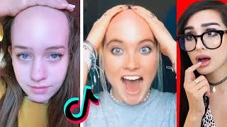 Funniest BAD Hairline Check Tik Toks [upl. by Brynn]