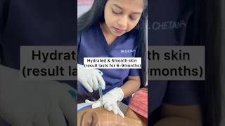 Skin booster hyaluronicacidskinvivejuvedermskinboostersmoothskinhydrationskincareinjection [upl. by Ilatan]