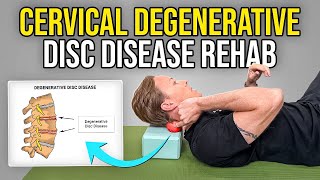 4 Exercises for Cervical Degenerative Disc Disease [upl. by Enelam683]