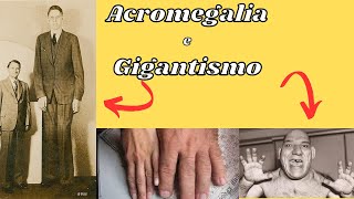 Acromegalia e Gigantismo Fisiopatologia Manifestações Clinicas Diagnóstico e Tratamento [upl. by Finley]