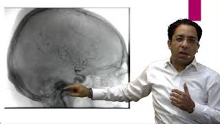 eQ Recent Exam Questions Radiology  Myelography by Dr Sumer Sethi [upl. by Nievelt895]