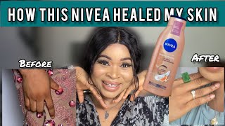 Shocking truth about Nivea vitamin C amp Tumeric body lotion🤯 [upl. by Roxane530]