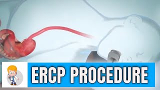 ERCP Endoscopic Retrograde Cholangiopancreatography procedure in 3D [upl. by Seagrave156]