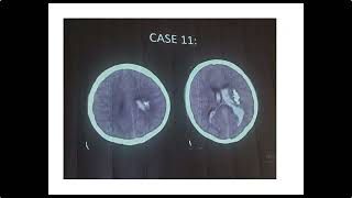 RADIOLOGY EXAM CASES [upl. by Noruq]