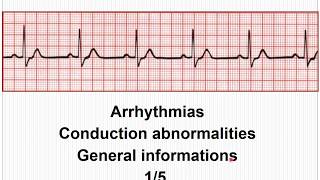 ECG Arrhythmias Conduction abnormalities  General concept 15 [upl. by Arretnahs]