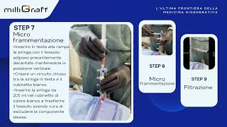 Procedura MilliGraft Dr Mezzana  Medicina rigenerativa  Dual Trend [upl. by Yrotciv]