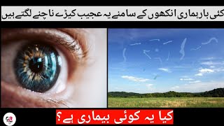 The Truth About Eye Floaters  Urdu  Hindi [upl. by Aletta]