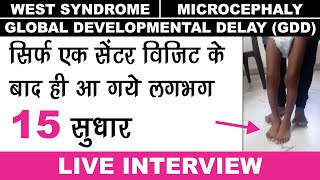 West Syndrome Recovery  Microcephaly Baby Treatment  Global Developmental Delay Case Presentation [upl. by Vally]