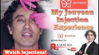 My Jeuveau Experience and Injections Dr Rajani [upl. by Elidad]