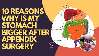 10 Reasons Why Is My Stomach Bigger After Appendix Surgery [upl. by Ecirehs]