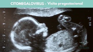 CITOMEGALOVIRUS  Visita pregestacional [upl. by Mylo]