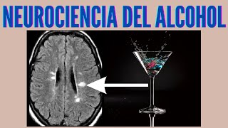 Neurociencia del alcohol y el alcoholismo [upl. by Aurelia]