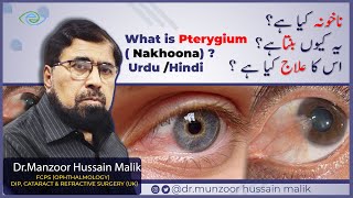 What is Pinguecula and Pterygium Prevention and Treatment [upl. by Dihgirb547]