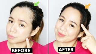 How To Naturally Grow Back Thinning Hairline amp Cover up Receding HairlineBeautyklove [upl. by Berget669]