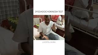 DYSDIADOCHOKINESIA TEST POSITIVE [upl. by Jala]