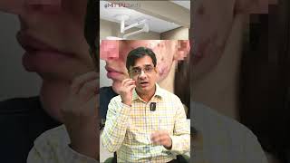 Understanding Acne Stages with Dr Sanjay Mittal  Clear Skin Tips AcneAwareness Skincare [upl. by Hudson]