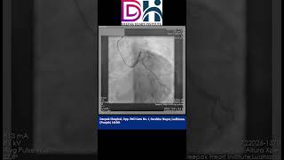 Coronary Angiography CAG Procedure  Deepak Heart institute [upl. by Gulick]