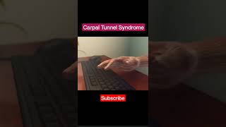 Carpal Tunnel Syndrome 3d animation shorts by MWM Medical [upl. by Dash376]