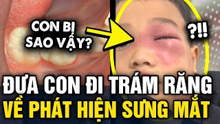 Đi trám răng về bé trai BỖNG SƯNG MẮT đi bệnh viện khám mới TÁ HỎA vì nhiễm trùng máu  Tin 3 Phút [upl. by Vish]