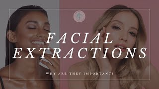 Are Facial Extractions Worth It [upl. by Alikam]