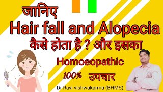 Hairfall treatment by homeopathy १००  stop hairfall  alopecia treatment  Dr Remedy Root [upl. by Bleier]