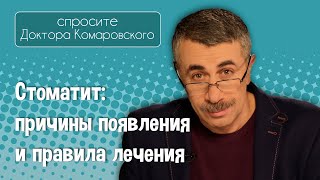 Стоматит причины появления и правила лечения  Доктор Комаровский [upl. by Anerom748]