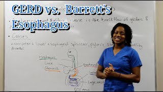 Medical Surgical Gastrointestinal System GERD amp Barretts Esophagus [upl. by Yerhpmuh623]