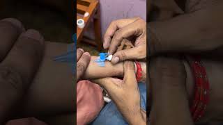 IV Cannulation  Intravenous Cannulation  Cannula kese lagate hain  cannula subscribe [upl. by Ahsiuqel665]