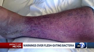 Flesheating bacteria cases in Florida double after Milton and Helene health department says [upl. by Disini]