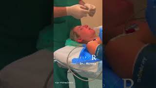 FULL Surgery process before General Anesthesia👃🏻IntubationSleep amp Recovery Αναισθησία amp ξύπνημα [upl. by Chemaram]