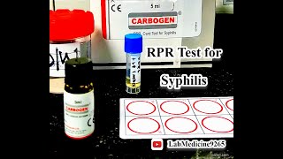 Rapid Plasma Reagin RPR Test  Serology  tulipdiagnosticspvtltdgoa [upl. by Jourdan728]