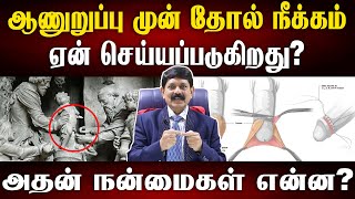 ஆண் குழந்தைகளுக்கு சுன்னத் தோன்றிய சுவாரஸ்ய கதை  History of Foreskin and its benefits [upl. by Mohkos233]