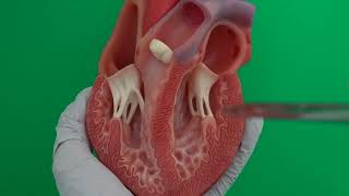 Trabeculae Carneae Papillary Muscles Chorda Tendineae in the Ventricles [upl. by Shaya]