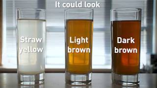 SEVERN TRENT  WHAT IS DISCOLOURED WATER [upl. by Aehtela]