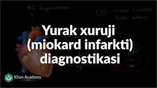 Yurak xuruji miokard infarkti diagnostikasi  Tibbiyot [upl. by Ayisan]