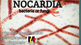 Nocardia ।। IntroductionScientific Classification Pathogenesis Laboratory Diagnosis of Nocardia [upl. by Godric412]