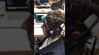 EEG 40 Hz Gamma induced by Vielight NeuroGamma Photobiomodulation for Neurofeedback [upl. by Heintz428]