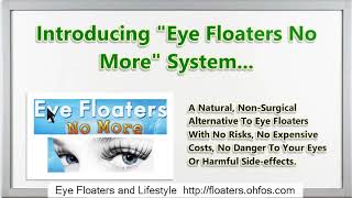 Floaters In Left Eye Icd 10 [upl. by Adnesor755]