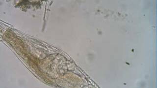 quotPregnantquot Bdelloid Rotifer [upl. by Samy70]