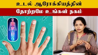 Bodys Internal Symptoms Is Nail Problem Tamil  நகம் வெளிப்படுத்தும் அறிகுறிகள் என்ன [upl. by Anirret]