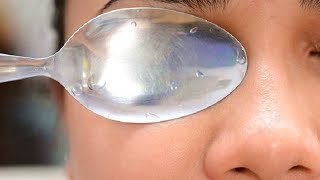 How To Remove Eye Bags in 20 Minutes The Results Will Surprise You [upl. by Hylan472]