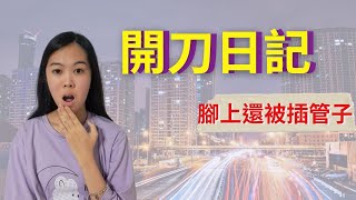 第一次開刀很緊張公開我的開刀經歷 [upl. by Bennet653]