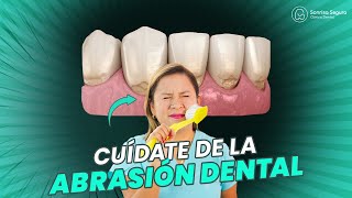 Cómo Prevenir y Tratar el Desgaste Dental 💡 [upl. by Hirz]