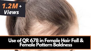 Use of QR 678 in Female Hair Fall amp Female Pattern Baldness  Dr Rinky Kapoor [upl. by Columbyne]