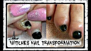 How to Pedicure Tutorial Cleaning Witch Toenail Transformation😜 ✔ [upl. by Colner170]